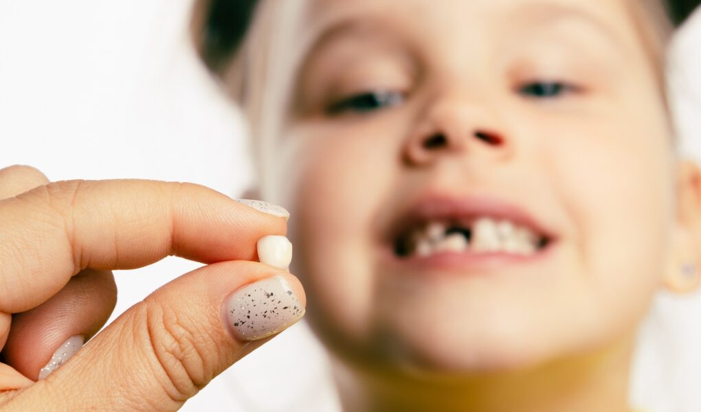 wypadanie zębów mlecznych