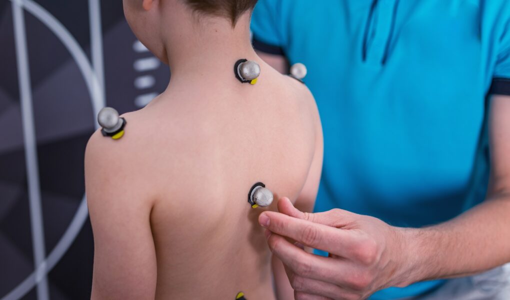 wada postawy u dziecka