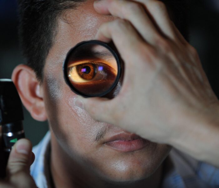 soczewka wewnątrzgałkowa